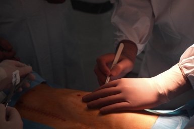 Хирурги удалили деталь катетера из грудной клетки разбившегося о дерево юного лыжника тг-канал (18+) детского хирурга Юрия Козлова